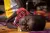 طفل على سرير في عيادة التغذية في مستشفى بوسانغوا في بوسانغوا، جمهورية أفريقيا الوسطى.