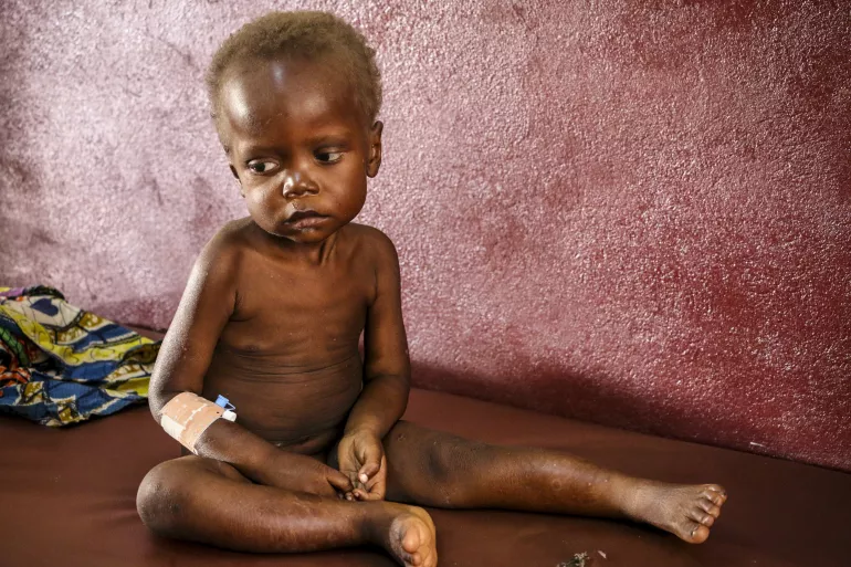 Un enfant souffrant de malnutrition assis sur un lit dans un centre de santé, en République centrafricaine 